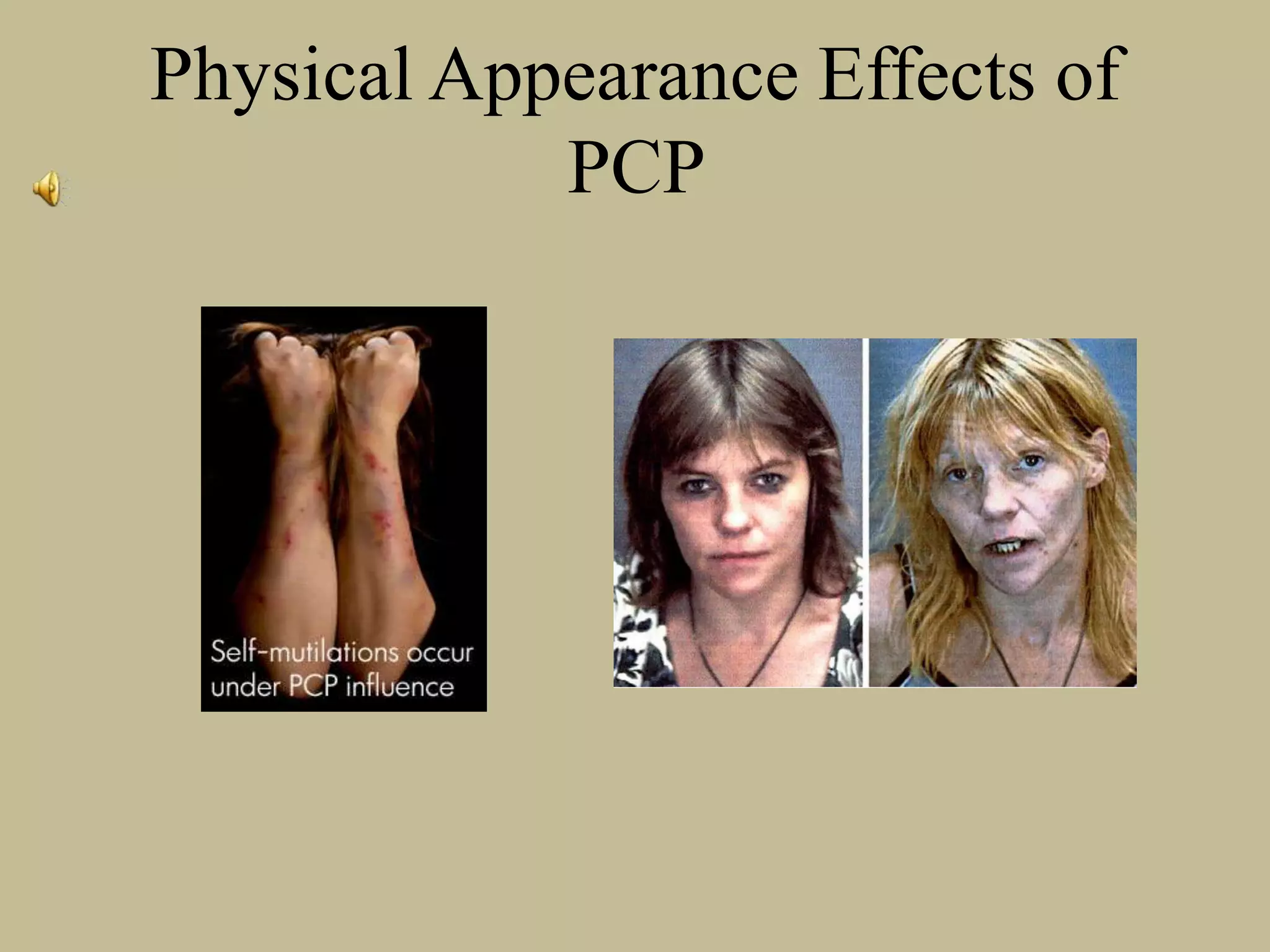 Physical Appearance Effects of
PCP
 