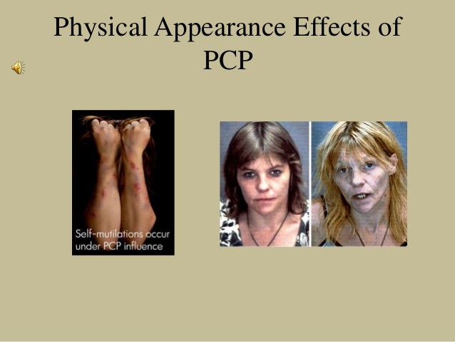 Pcp