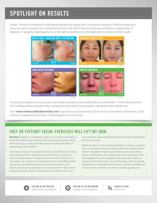 Fiction. Gravity is constantly tugging on our skin and while a
stack of weights may work great for toning your biceps, facial
exercises can actually have the opposite unwanted effect of
enhancing your wrinkles.
Your face contains 44 muscles that are constantly contracting
and relaxing. These muscles are connected to your skin, so
every time they move, the skin moves with them. When you
sip, laugh, cry or speak, your expressions etch indelible marks
across your forehead, around your mouth, between your
brows and along the perimeters of your eyes. Over time, these
repeated motions lead to deep lines and wrinkles. The more
you make the same repetitive facial movements, the deeper
the lines become.
While we don’t want to lose the ability to express ourselves,
there are solutions that can help us lose the wrinkles that
follow. Collagen-enhancing ingredients can help create
firmer-looking skin. For expression lines, hyaluronic acid
and peptides are now available in an innovative delivery
system known as Liquid Cone Technology, offering a great
alternative to injectables for helping to fill the wrinkles and
create a more youthful, smoother-looking appearance.
FACT OR FICTION? FACIAL EXERCISES WILL LIFT MY SKIN.
SPOTLIGHT ON RESULTS
UNBLEMISH REGIMEN
REVERSE POWER PACK
SOOTHE REGIMEN
ACUTE CARE + REDEFINE AMP IT UP SPECIAL
BEFORE AFTER
Consultant
BEFORE AFTER
Consultant
BEFORE AFTER
Consultant
BEFORE AFTER
Customer
Rodan + Fields is committed to offering real people real results with our skincare products. While everyday skin
concerns can be complex, the solutions don’t have to be. That’s why our products are based on a philosophy of
Regimens—using the right ingredients, in the right formulations, in the right order to achieve visible results.
Track your progress on your journey to great skin and share your results with us on the Rodan + Fields Results micro-
site. Nothing makes us happier than seeing how our products are helping to change skin and change lives.
Visit www.rodanandfieldsresults.com to upload your pictures today. If your story is selected for publication, you’ll
receive a complimentary Rodan + Fields Regimen of your choice.
DERM RF BLOG
dermrf.com
FOLLOW US ON TWITTER
twitter.com/RodanFieldsHQ
FOLLOW US ON INSTAGRAM
instagram.com/rodanfields
 