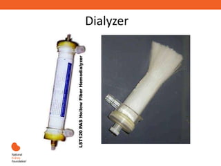 Dialyzer
 