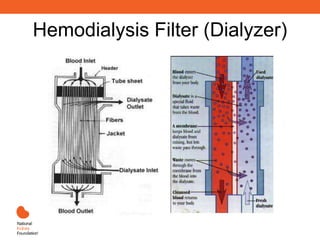 Hemodialysis Filter (Dialyzer)
 