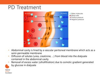 • Abdominal cavity is lined by a vascular peritoneal membrane which acts as a
semi-permeable membrane
• Diffusion of solutes (urea, creatinine, …) from blood into the dialysate
contained in the abdominal cavity
• Removal of excess water (ultrafiltration) due to osmotic gradient generated
by glucose in dialysate
PD Treatment
 