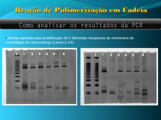 Reação de Polimerização em Cadeia

       Como analisar os resultados da PCR

•Bandas geradas pela amplificação de 5 diferentes receptores de membrana de
macrófagos de camundongo (Lanes 2 a 6)
 