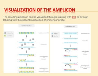 VISUALIZATION OF THE AMPLICON
The resulting amplicon can be visualized through staining with dye or through
labeling with fluorescent nucleotides or primers or probe.
 