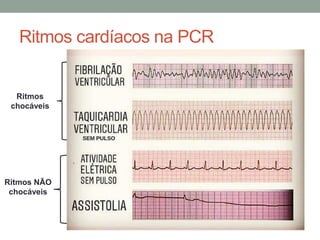 Ritmos cardíacos na PCR
Ritmos
chocáveis
Ritmos NÃO
chocáveis
 