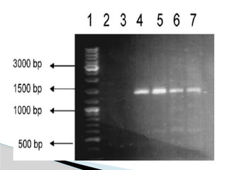 Polymerase Chain Reaction a technique used in Molecular Biology | PPTX