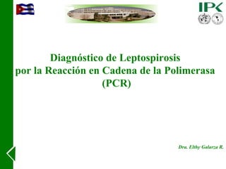 Diagnóstico de Leptospirosis
por la Reacción en Cadena de la Polimerasa
(PCR)
Dra. Elthy Galarza R.
 
