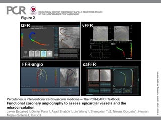 EDUCATIONAL CONTENT ENDORSED BY EAPCI, A REGISTERED BRANCH
OF THE EUROPEAN SOCIETY OF CARDIOLOGY
Figure 2
©
2022
Europa
Digital
&
Publishing.
All
rights
reserved.
Percutaneous interventional cardiovascular medicine – The PCR-EAPCI Textbook
Functional coronary angiography to assess epicardial vessels and the
microcirculation
Javier Escaned1, Daniel Faria1, Asad Shabbir1, Lin Wang1, Shengxian Tu2, Nieves Gonzalo1, Hernán
Mejía-Rentería1, Xu Bo3
 