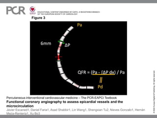 EDUCATIONAL CONTENT ENDORSED BY EAPCI, A REGISTERED BRANCH
OF THE EUROPEAN SOCIETY OF CARDIOLOGY
Figure 3
©
2022
Europa
Digital
&
Publishing.
All
rights
reserved.
Percutaneous interventional cardiovascular medicine – The PCR-EAPCI Textbook
Functional coronary angiography to assess epicardial vessels and the
microcirculation
Javier Escaned1, Daniel Faria1, Asad Shabbir1, Lin Wang1, Shengxian Tu2, Nieves Gonzalo1, Hernán
Mejía-Rentería1, Xu Bo3
 