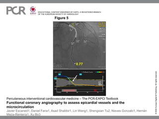 EDUCATIONAL CONTENT ENDORSED BY EAPCI, A REGISTERED BRANCH
OF THE EUROPEAN SOCIETY OF CARDIOLOGY
Figure 5
©
2022
Europa
Digital
&
Publishing.
All
rights
reserved.
Percutaneous interventional cardiovascular medicine – The PCR-EAPCI Textbook
Functional coronary angiography to assess epicardial vessels and the
microcirculation
Javier Escaned1, Daniel Faria1, Asad Shabbir1, Lin Wang1, Shengxian Tu2, Nieves Gonzalo1, Hernán
Mejía-Rentería1, Xu Bo3
 