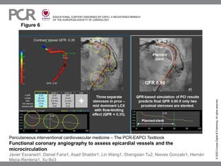 EDUCATIONAL CONTENT ENDORSED BY EAPCI, A REGISTERED BRANCH
OF THE EUROPEAN SOCIETY OF CARDIOLOGY
Figure 6
©
2022
Europa
Digital
&
Publishing.
All
rights
reserved.
Percutaneous interventional cardiovascular medicine – The PCR-EAPCI Textbook
Functional coronary angiography to assess epicardial vessels and the
microcirculation
Javier Escaned1, Daniel Faria1, Asad Shabbir1, Lin Wang1, Shengxian Tu2, Nieves Gonzalo1, Hernán
Mejía-Rentería1, Xu Bo3
 