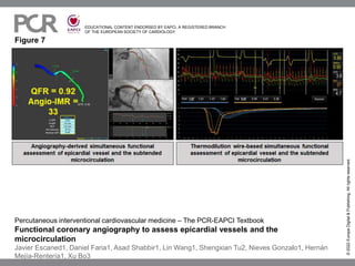 EDUCATIONAL CONTENT ENDORSED BY EAPCI, A REGISTERED BRANCH
OF THE EUROPEAN SOCIETY OF CARDIOLOGY
Figure 7
©
2022
Europa
Digital
&
Publishing.
All
rights
reserved.
Percutaneous interventional cardiovascular medicine – The PCR-EAPCI Textbook
Functional coronary angiography to assess epicardial vessels and the
microcirculation
Javier Escaned1, Daniel Faria1, Asad Shabbir1, Lin Wang1, Shengxian Tu2, Nieves Gonzalo1, Hernán
Mejía-Rentería1, Xu Bo3
 