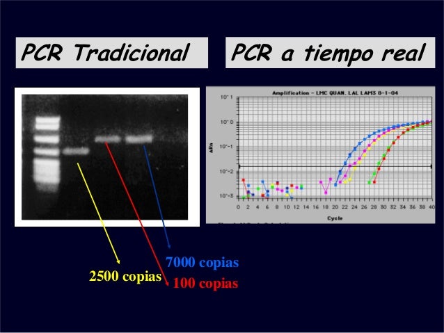 Pcr tradicional y tiempo real