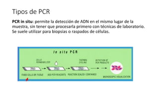 Tipos de PCR 
PCR in situ: permite la detección de ADN en el mismo lugar de la 
muestra, sin tener que procesarla primero con técnicas de laboratorio. 
Se suele utilizar para biopsias o raspados de células. 
 