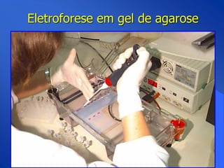 Eletroforese em gel de agarose
 