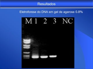 Resultados

Eletroforese do DNA em gel de agarose 0.8%
 