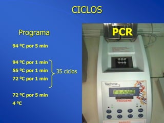 CICLOS

  Programa                       PCR
94 0C por 5 min


94 0C por 1 min
55 0C por 1 min   35 ciclos
72 0C por 1 min


72 0C por 5 min
4 0C
 