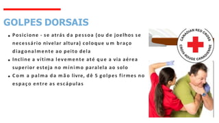 GOLPES DORSAIS
Posicione - se atrás da pessoa (ou de joelhos se
necessário nivelar altura) coloque u m braço
diagonalmente ao peito dela
Incline a vítima levemente até que a via aérea
superior esteja no mínimo paralela ao solo
C o m a palma da m ã o livre, dê 5 golpes firmes no
espaço entre as escápulas
 