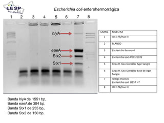 Escherichia coli
7
enterohermorrágica
81 2 3 4 5 6
hlyA
eaeA
Stx2
Stx1
Banda hlyAde 1551 bp,
Banda eaeAde 384 bp,
Banda Stx1 de 255 bp,
Banda Stx2 de 150 bp.
CARRIL MUESTRA
1 ΦX 174/Hae III
2 BLANCO
3 Escherichia hermanii
4 Escherichia coli ATCC 25922
5 Cepa H. Gea González Agar Sangre
6 Cepa H. Gea González Base de Agar
Sangre
7 Testigo Positivo
Escherichia coli O157 H7
8 ΦX 174/Hae III
 