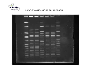 CASO E.coli EN HOSPITAL INFANTIL
 
