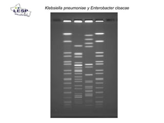Klebsiella pneumoniae y Enterobacter cloacae
 
