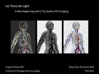 Let There Be Light
         A New Beginning with [11C]-choline PET Imaging




Eugene D Kwon MD                                          Mayo Clinic (Rochester MN)
Professor of Urology and Immunology                                       PCRI 2013
 
