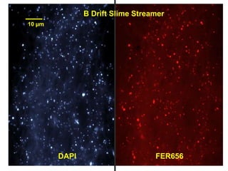10 µm
DAPI FER656
B Drift Slime Streamer
 