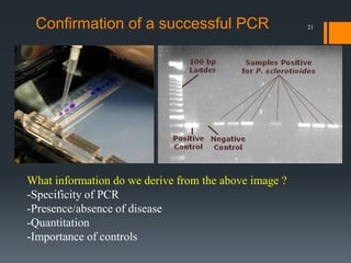 21Confirmation of a successful PCR
What information do we derive from the above image ?
-Specificity of PCR
-Presence/absence of disease
-Quantitation
-Importance of controls
 