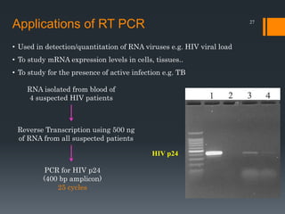 27
Applications of RT PCR
• Used in detection/quantitation of RNA viruses e.g. HIV viral load
• To study mRNA expression levels in cells, tissues..
• To study for the presence of active infection e.g. TB
HIV p24
RNA isolated from blood of
4 suspected HIV patients
Reverse Transcription using 500 ng
of RNA from all suspected patients
PCR for HIV p24
(400 bp amplicon)
25 cycles
 