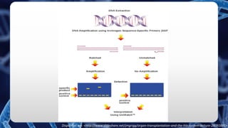 Disponível em: <http://www.slideshare.net/jmgrigg/organ-transplantation-and-the-hla-system-lecture-28091691>
 
