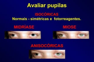 ISOCÓRICAS Normais - simétricas e  fotorreagentes. MIOSE MIDRÍASE ANISOCÓRICAS Avaliar pupilas 
