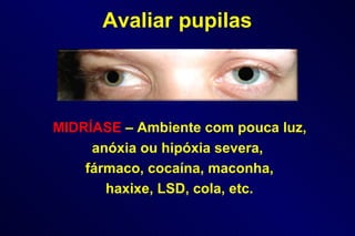 MIDRÍASE   – Ambiente com pouca luz,  anóxia ou hipóxia severa, fármaco, cocaína, maconha, haxixe, LSD, cola, etc. Avaliar pupilas 