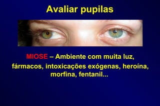 MIOSE   – Ambiente com muita luz,  fármacos, intoxicações exógenas, heroína, morfina, fentanil... Avaliar pupilas 