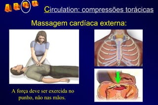 A força deve ser exercida no punho, não nas mãos.  Massagem cardíaca externa: A  B  C  D C irculation: compressões torácicas 
