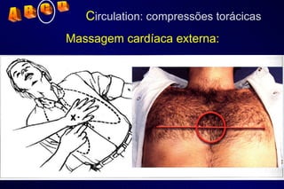 C irculation: compressões torácicas Massagem cardíaca externa: A  B  C  D 