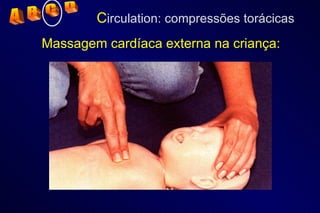C irculation: compressões torácicas Massagem cardíaca externa na criança: A  B  C  D 