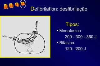 D efibrilation: desfibrilação Tipos: Monofasico 200 - 300 - 360 J Bifasico 120 - 200 J A  B  C  D 