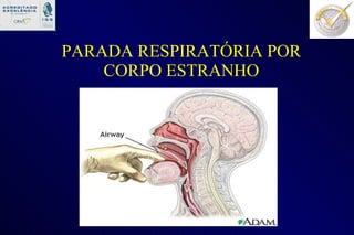 PARADA RESPIRATÓRIA POR CORPO ESTRANHO 