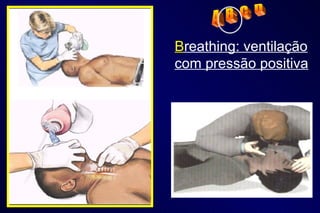 B reathing: ventilação com pressão positiva A  B  C  D 