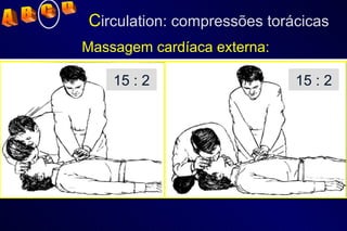 15 : 2 15 : 2 Massagem cardíaca externa: C irculation: compressões torácicas A  B  C  D 