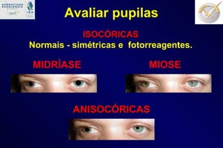 ISOCÓRICAS Normais - simétricas e  fotorreagentes. MIOSE MIDRÍASE ANISOCÓRICAS Avaliar pupilas 