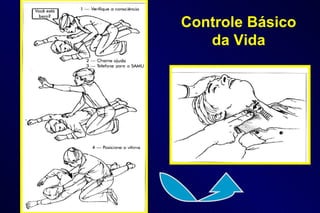Controle Básico da Vida 