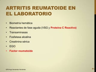 ARTRITIS REUMATOIDE EN
EL LABORATORIO
• Biometría hemática
• Reactantes de fase aguda (VSG y Proteína C Reactiva)
• Transaminasas
• Fosfatasa alcalina
• Creatinina sérica
• EGO

QFB Hugo Hernández Hernández

7

• Factor reumatoide

 