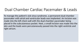 Dual Chamber Cardiac Pacemaker & Leads
To manage the patient’s sick sinus syndrome, a permanent dual chamber
pacemaker with atrial and ventricular leads was implanted. An incision was
made into the left chest wall with the dual chamber pacemaker being
placed in the subcutaneous pocket. Next, a small incision was made into the
skin and the leads were percutaneously passed into the right ventricle and
right atrium.
 