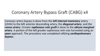 Coronary Artery Bypass Graft (CABG) x4
Coronary artery bypass is done from the left internal mammary artery
(LIMA) to the left anterior descending artery, the diagonal artery, and the
ramus artery. Greater saphenous vein graft is done to the obtuse marginal
artery. A portion of the left greater saphenous vein was harvested using an
open approach. The procedure was completed utilizing cardiopulmonary
bypass.
 