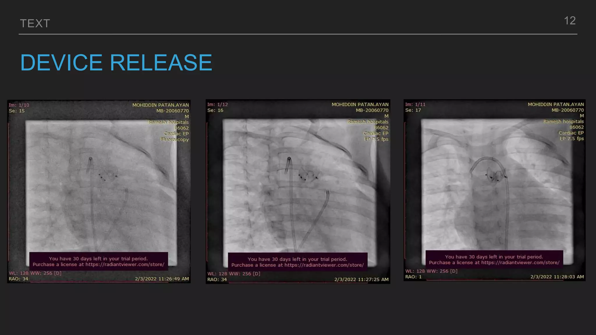 TEXT
DEVICE RELEASE
12