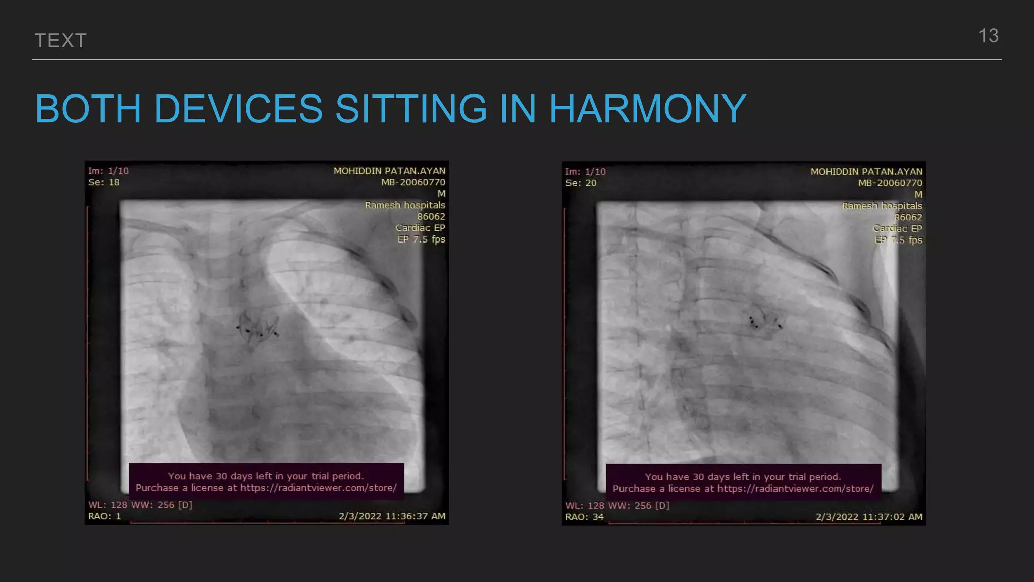 TEXT
BOTH DEVICES SITTING IN HARMONY
13