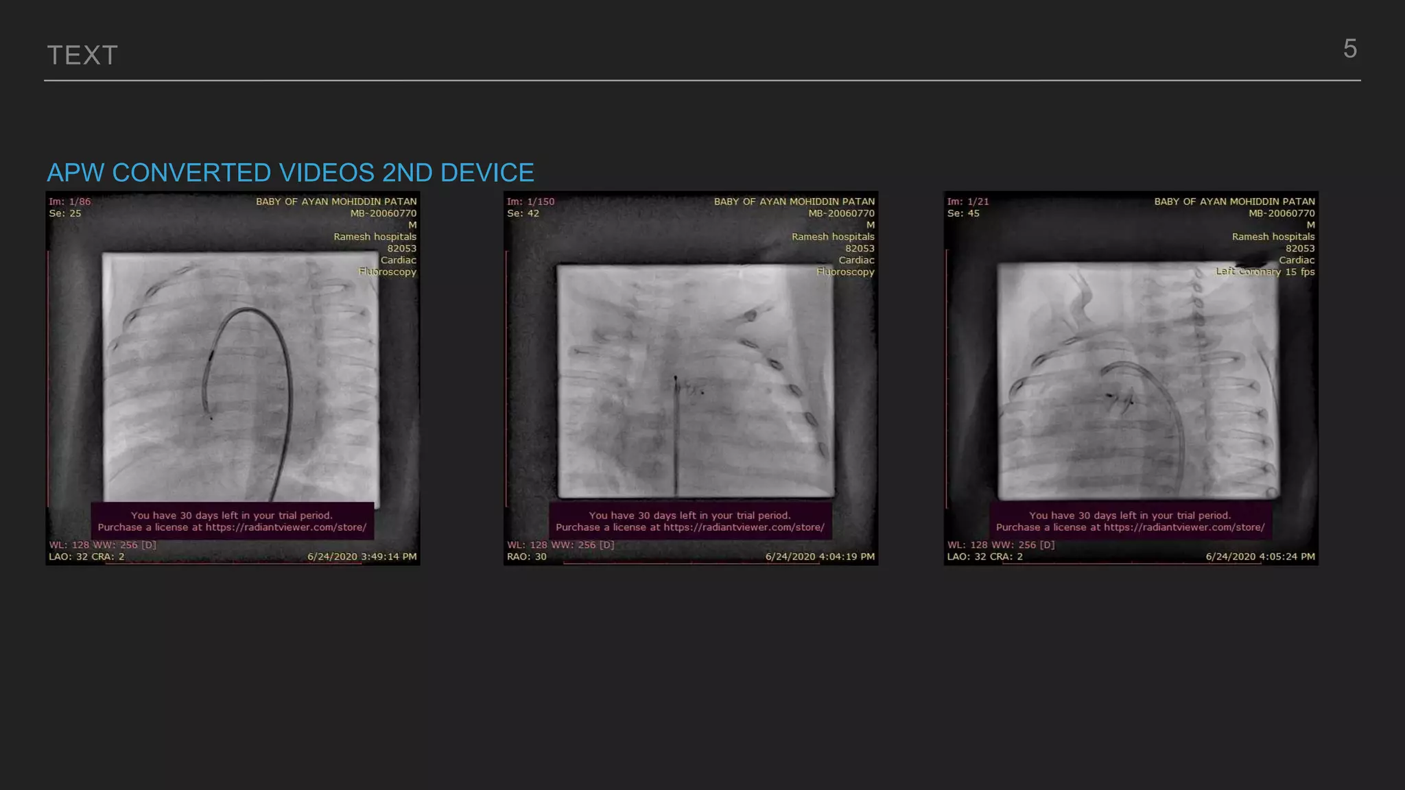 TEXT
APW CONVERTED VIDEOS 2ND DEVICE
5