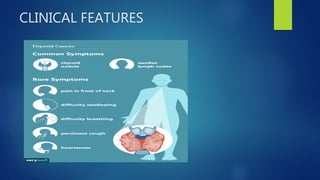 CLINICAL FEATURES
 