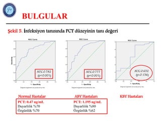 BULGULAR
Şekil 5. İnfeksiyon tanısında PCT düzeyinin tanı değeri
ABY Hastaları
KBY hastaları
Normal Hastalar
AUC:0.782
p<0.001 AUC:0.777
(p<0.001)
AUC:0.782
(p<0.001)
KBY Hastaları
AUC:0.652
(p=0.156)
PCT: 1.195 ng/mL
Duyarlılık %80
Özgünlük %62
PCT: 0.47 ng/mL
Duyarlılık %70
Özgünlük %70
 